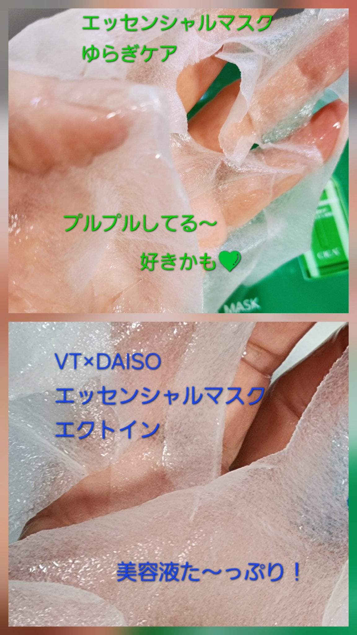 VT リードルS トライアル3ステップキット ペプチド/VT/トライアルキットを使ったクチコミ(4枚目)