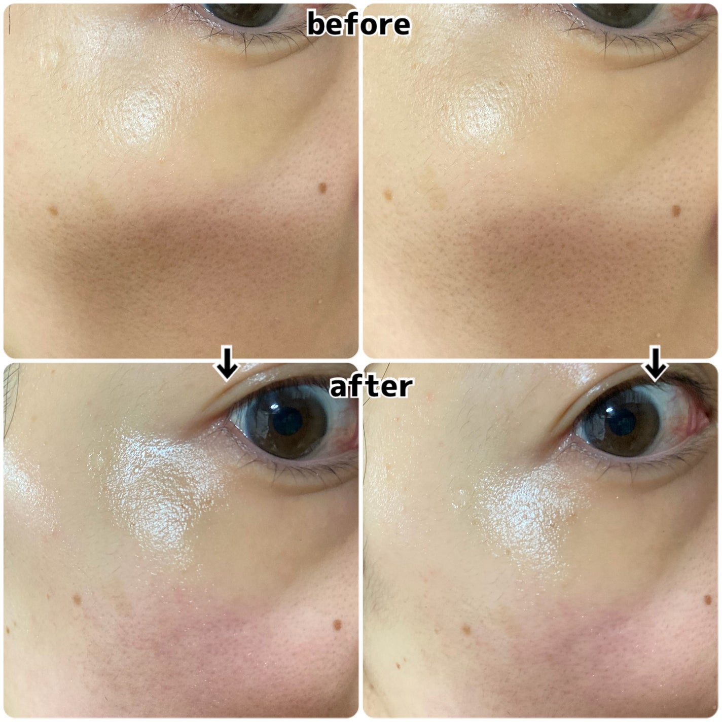 ブレミッシュバブルマッドマスク/PAPA RECIPE/スクラブ・ゴマージュを使ったクチコミ(4枚目)