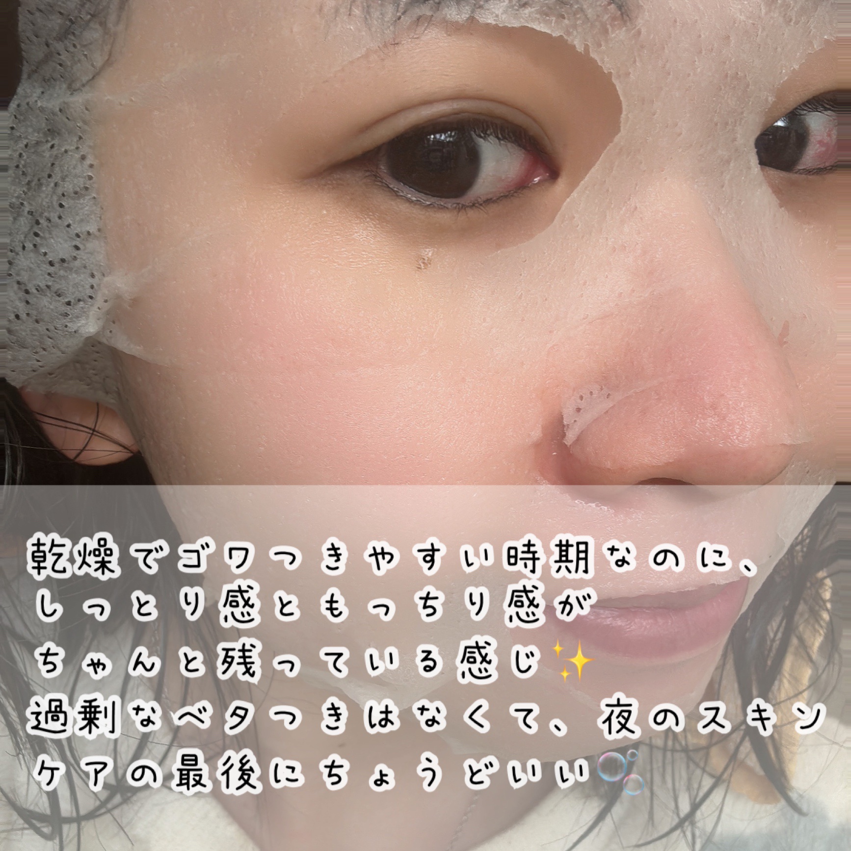 リードルS レチA EXマスク/VT/シートマスク・パックを使ったクチコミ（3枚目）