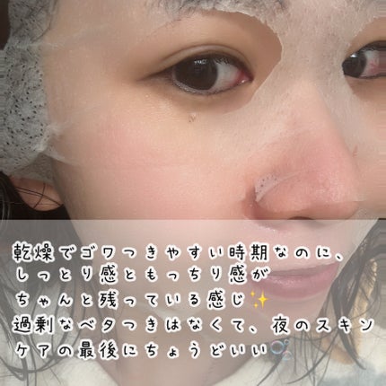 リードルS レチA EXマスク/VT/シートマスク・パックを使ったクチコミ(3枚目)