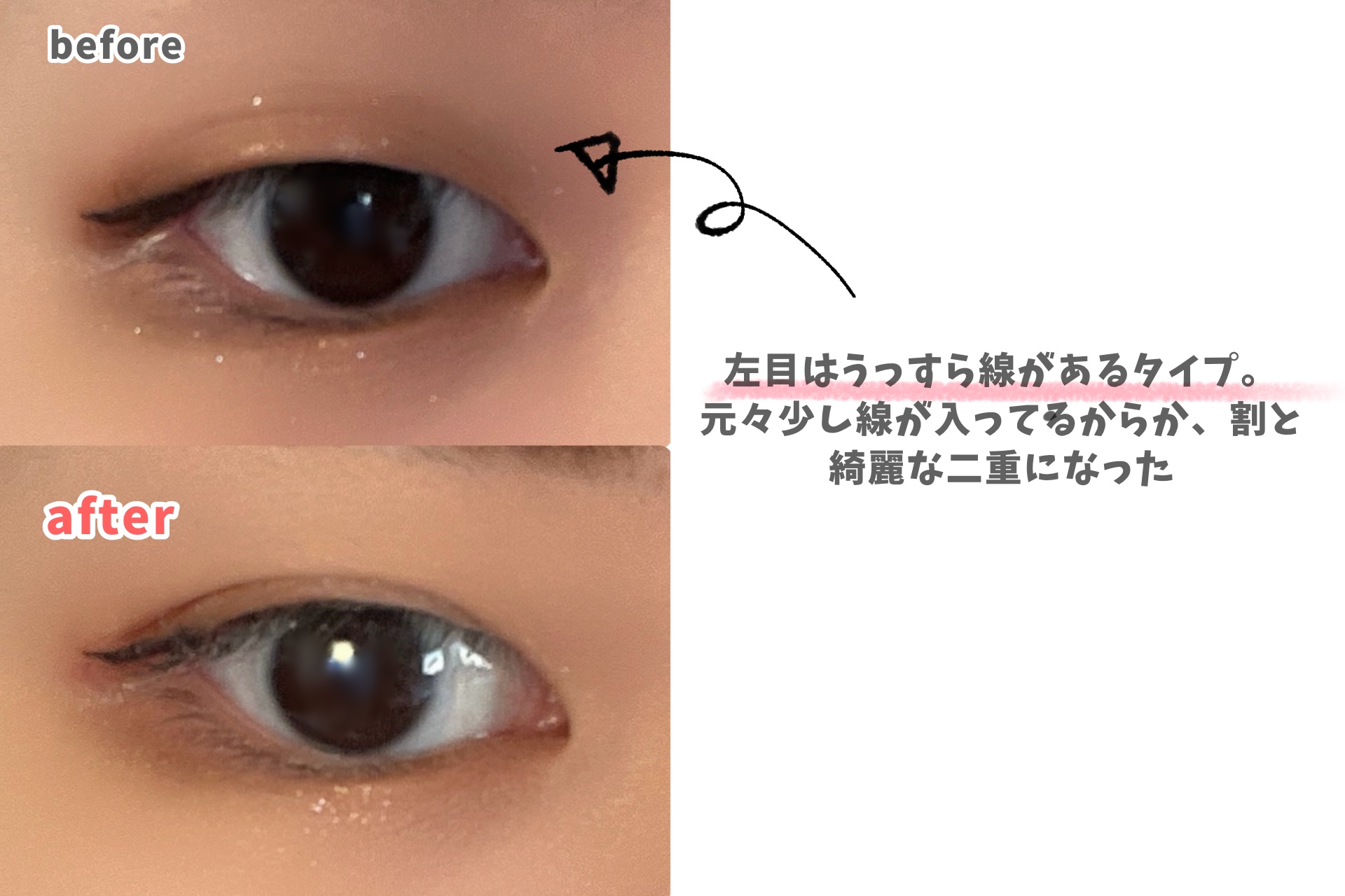 ダブリー/ルドゥーブル/二重まぶた用アイテムを使ったクチコミ（3枚目）