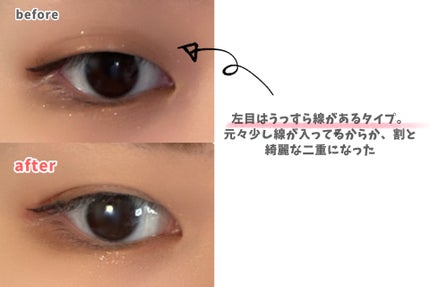 ダブリー/ルドゥーブル/二重まぶた用アイテムを使ったクチコミ(3枚目)