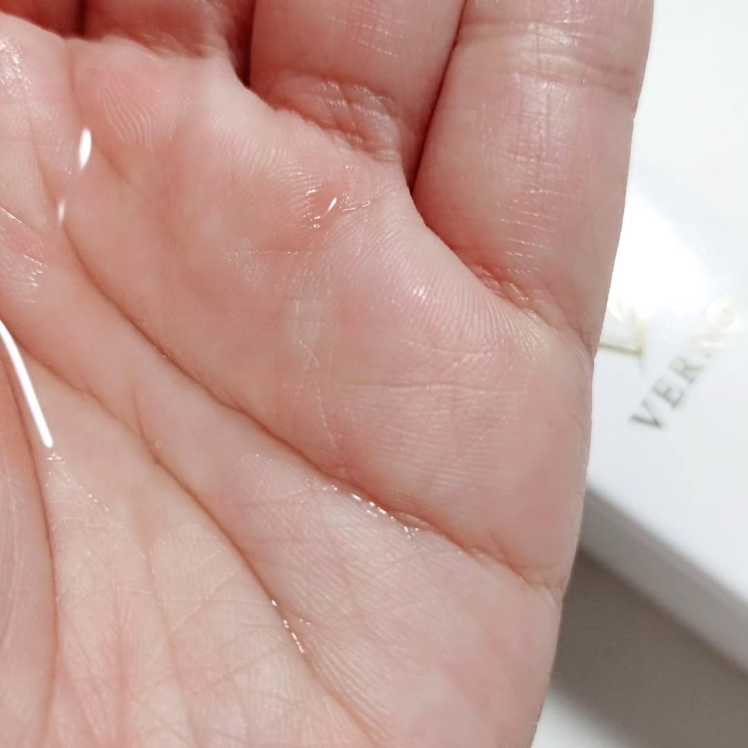 VERNO SKIN ローション〈医薬部外品〉/VERNO SKIN CARE/化粧水を使ったクチコミ（2枚目）