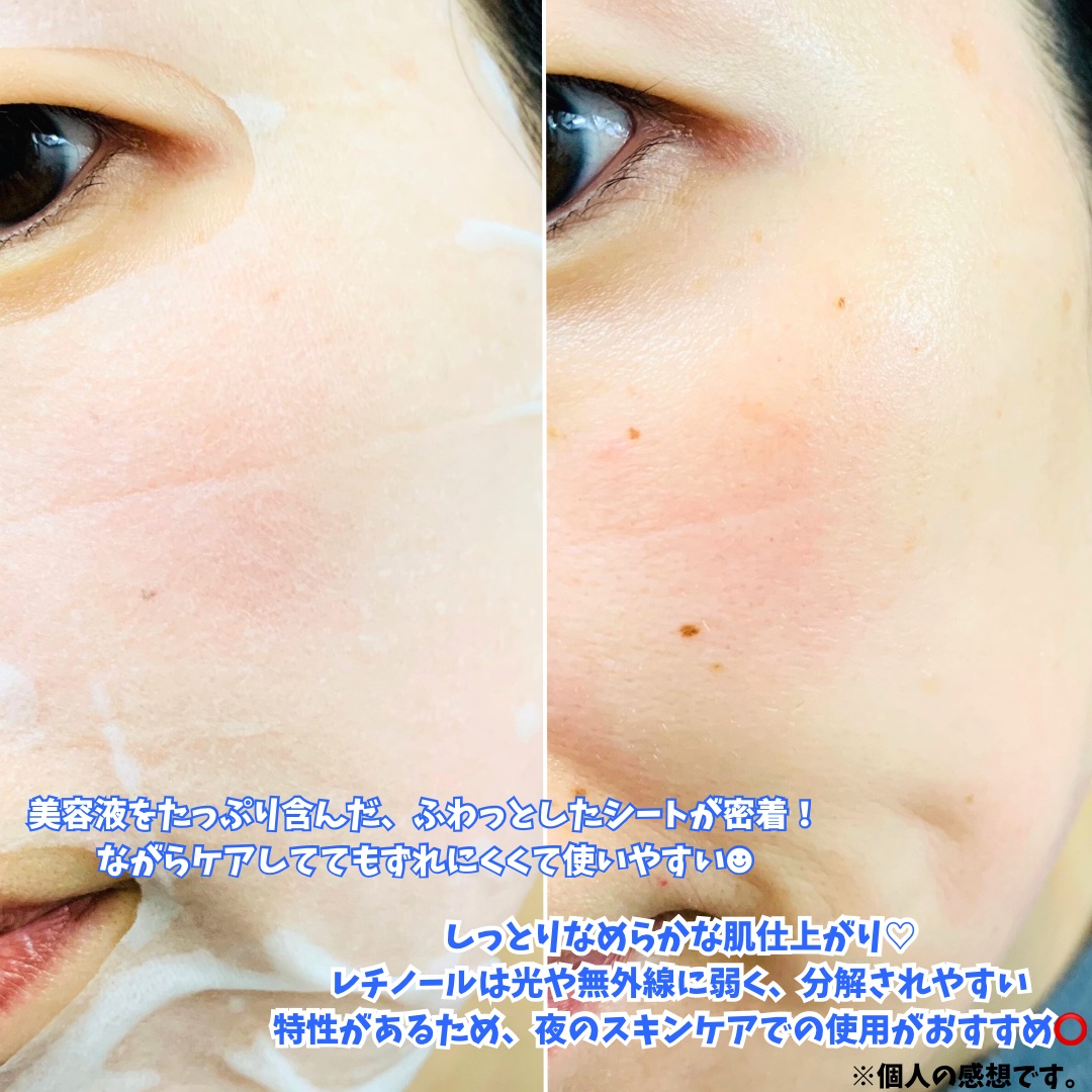 NMNブルースーパーレチノールデイリーターンオーバーマスク/Milk Touch/シートマスク・パックを使ったクチコミ（3枚目）
