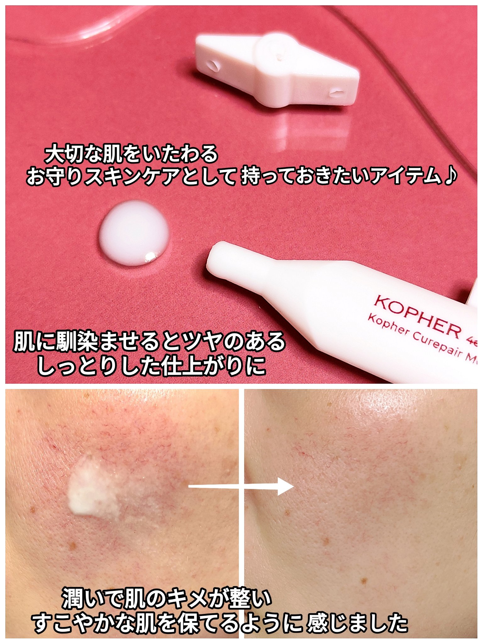 SOSメルダーシステム/KOPHER/フェイスクリームを使ったクチコミ（3枚目）