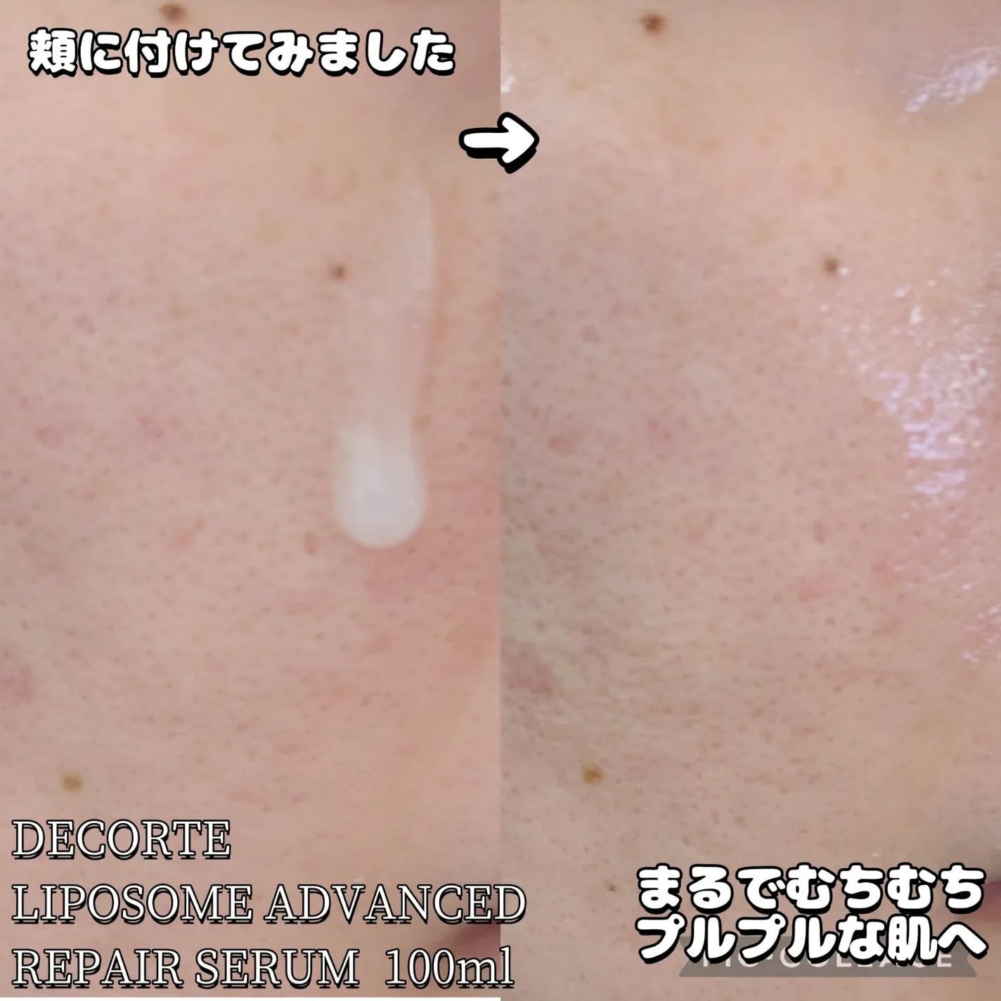 リポソーム アドバンスト リペアセラム/DECORTÉ/美容液を使ったクチコミ(4枚目)