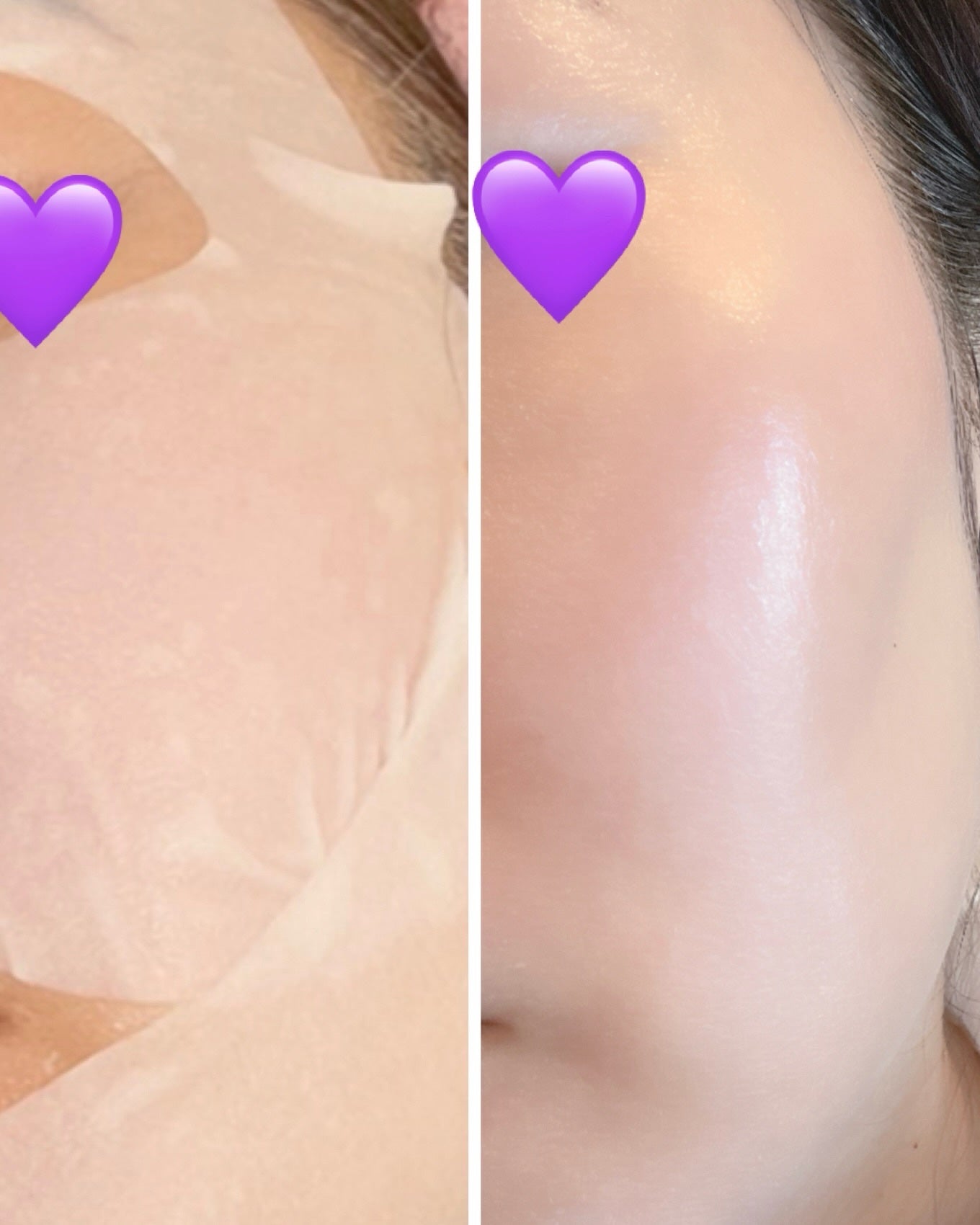 9番 NMNバイオリフトラッピングマスク/numbuzin/シートマスク・パックを使ったクチコミ(4枚目)