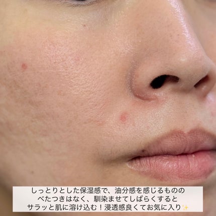 スージングクリーム/ZEROID/フェイスクリームを使ったクチコミ(8枚目)