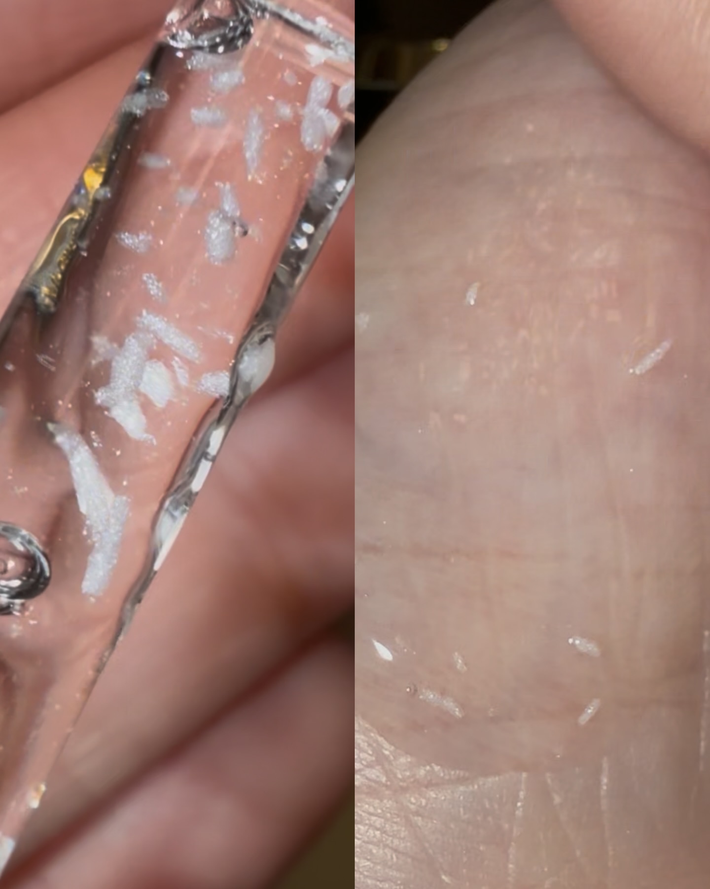 プロバイオダーム™ 3Dリフティング バイオトクシルPLGAセラム/BIOHEAL BOH/美容液を使ったクチコミ（2枚目）