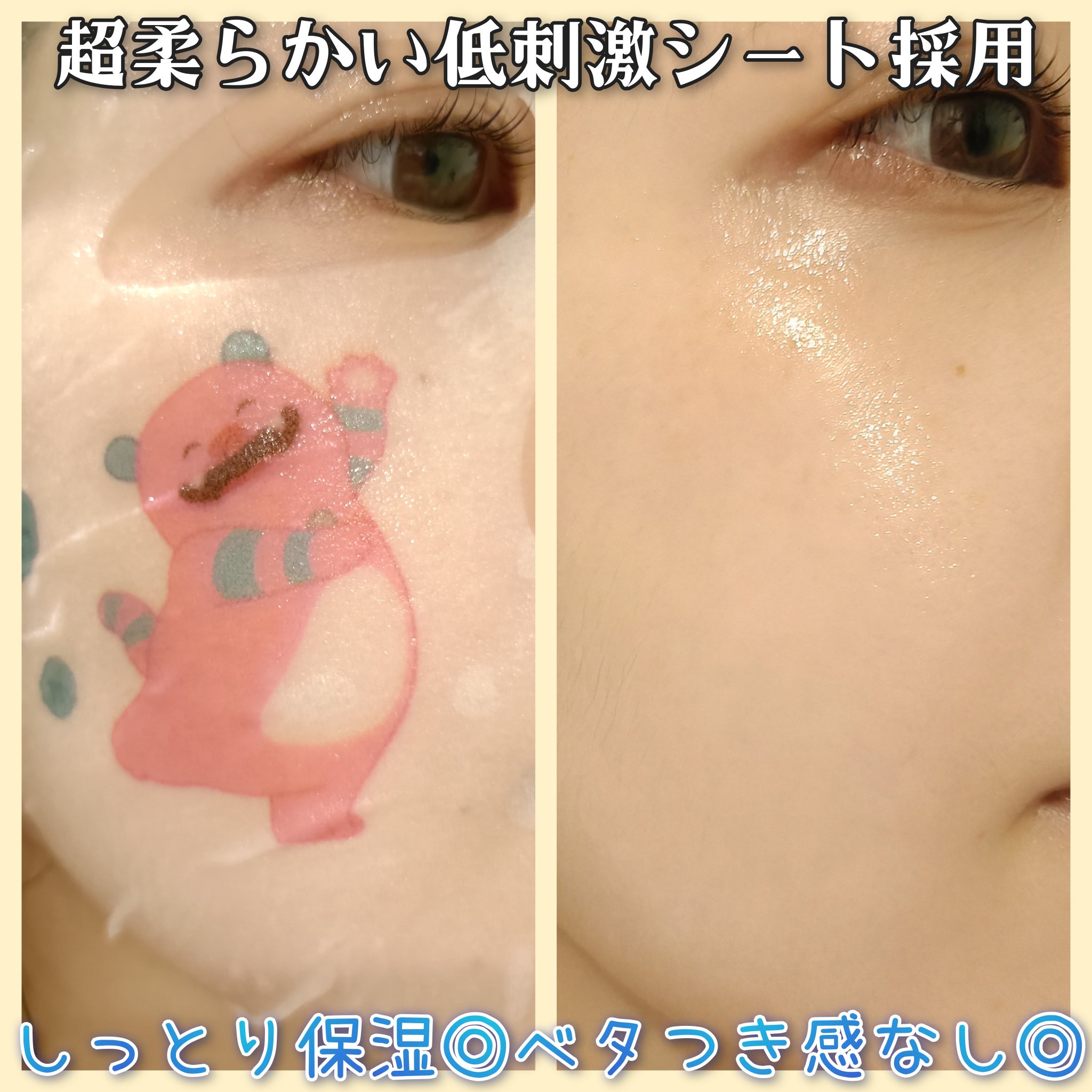 マデカッソシド エッセンシャルマスク/MEDIHEAL/シートマスク・パックを使ったクチコミ（3枚目）