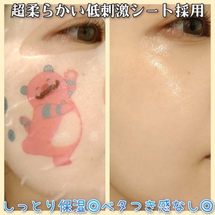 マデカッソシド エッセンシャルマスク/MEDIHEAL/シートマスク・パックを使ったクチコミ(3枚目)