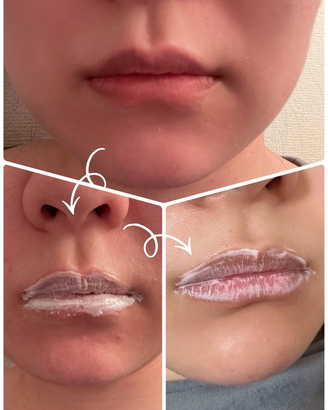 ノイズカットリップパック/メディプラス/リップクリームを使ったクチコミ(4枚目)