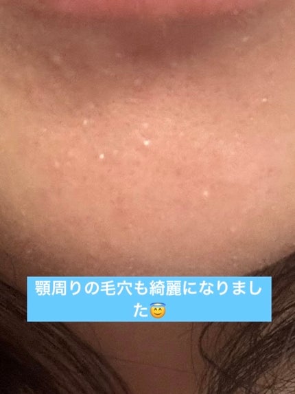 ホットクレンジングゲル マッサージプラス 使い切り6包/マナラ/クレンジングジェルの画像