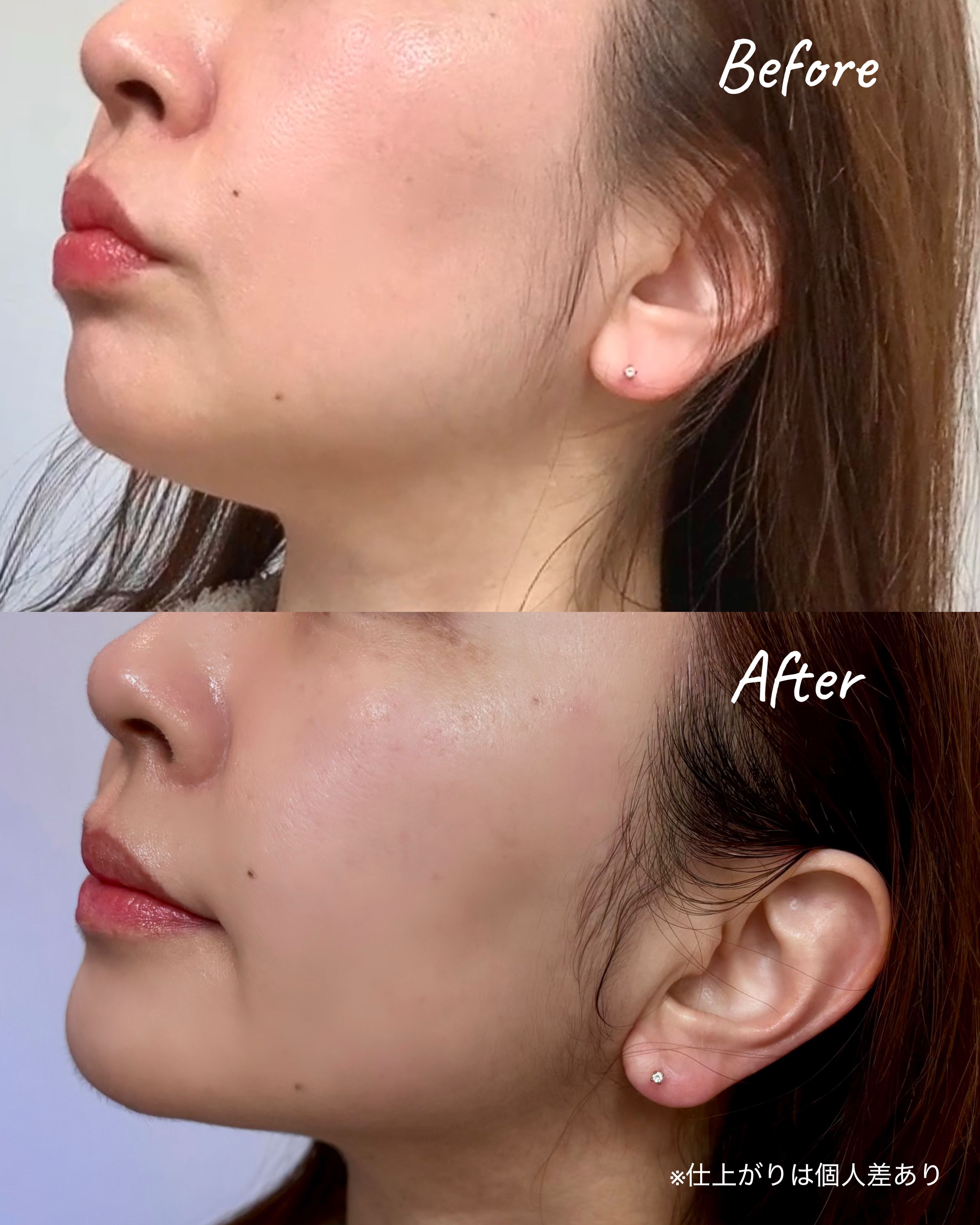 9番 NMNバイオリフトラッピングマスク/numbuzin/シートマスク・パックを使ったクチコミ（2枚目）