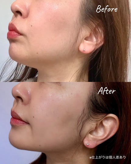 9番 NMNバイオリフトラッピングマスク/numbuzin/シートマスク・パックを使ったクチコミ(2枚目)