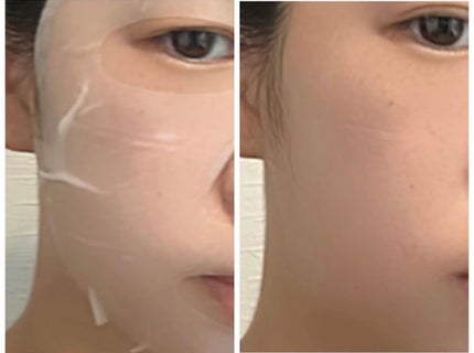 ローゼPDRNエッセンシャルマスクヘルシーグロウ/MEDIHEAL/シートマスク・パックを使ったクチコミ(3枚目)