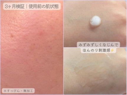 リードルショット300/VT/美容液を使ったクチコミ(2枚目)