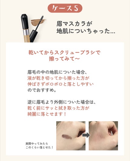 ãµãð·å¢æãåå¿è
ã¡ã€ã¯ on LIPS ãä»åã¯ã¡ã€ã¯å€±æããæããã«ã§ããå¯ŸåŠæ³ã5ã€ã玹ä»ããŸããðš..ãïŒ8æç®ïŒ