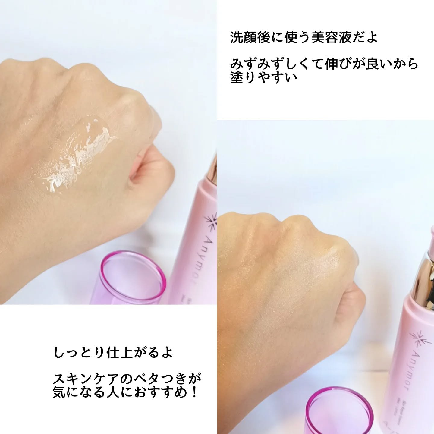 薬用美容液 Anymor/Anymor/美容液を使ったクチコミ（3枚目）