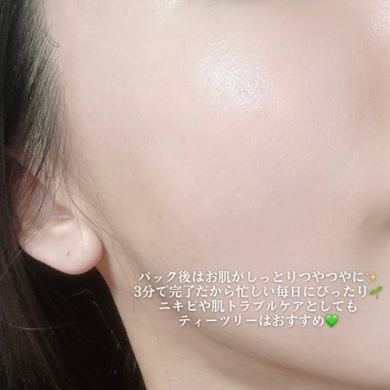 ティーツリー エッセンシャルマスクカーミングモイスチャー/MEDIHEAL/シートマスク・パックを使ったクチコミ(3枚目)