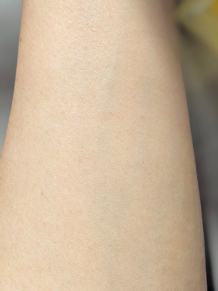 アゼライン酸CICA37セラム/オーズナリー/美容液を使ったクチコミ(6枚目)