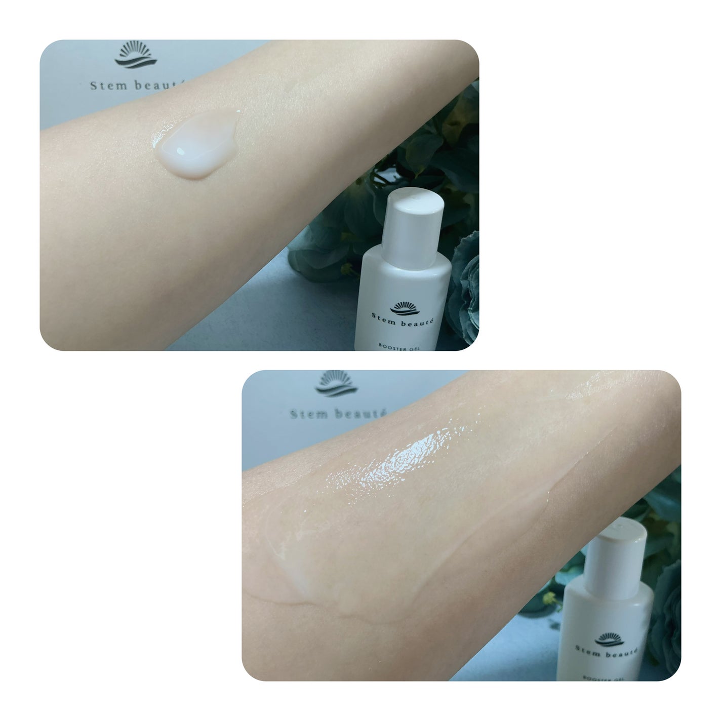 New Trial set/ステムボーテ/トライアルキットを使ったクチコミ(4枚目)