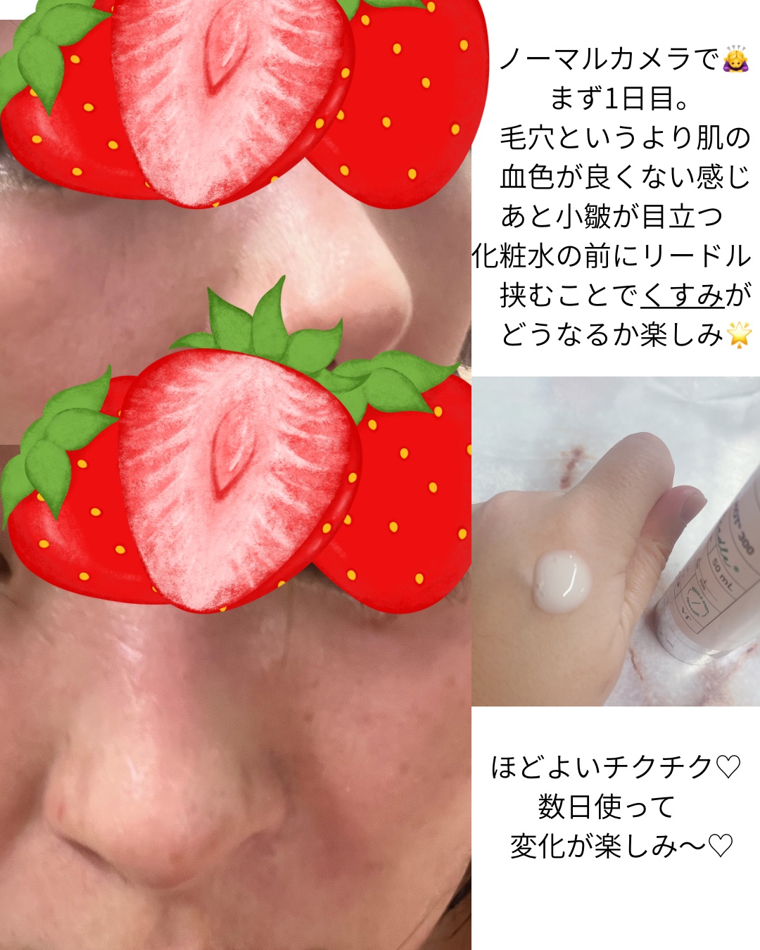 リードルショット300/VT/美容液を使ったクチコミ（2枚目）