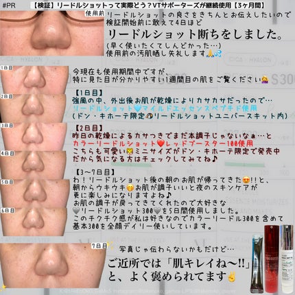 リードルショット300/VT/美容液を使ったクチコミ(2枚目)