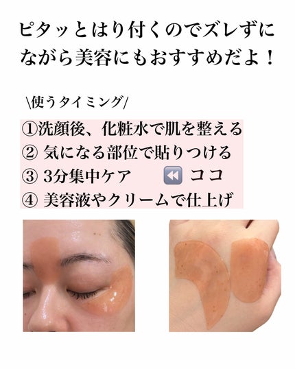 ブレミッシュケアアップ セラム/ISOI/美容液を使ったクチコミ(5枚目)