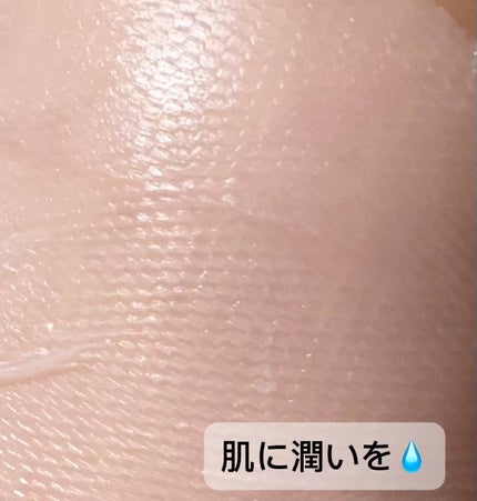 トラブルパッチマスク/EIOM/その他スキンケアを使ったクチコミ(5枚目)