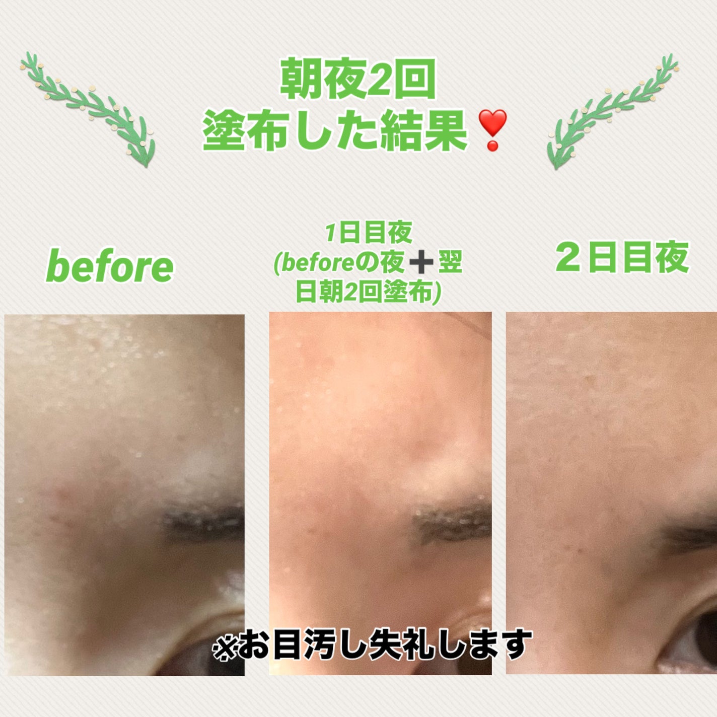 インテカ スージングクリーム/make prem/フェイスクリームを使ったクチコミ(3枚目)