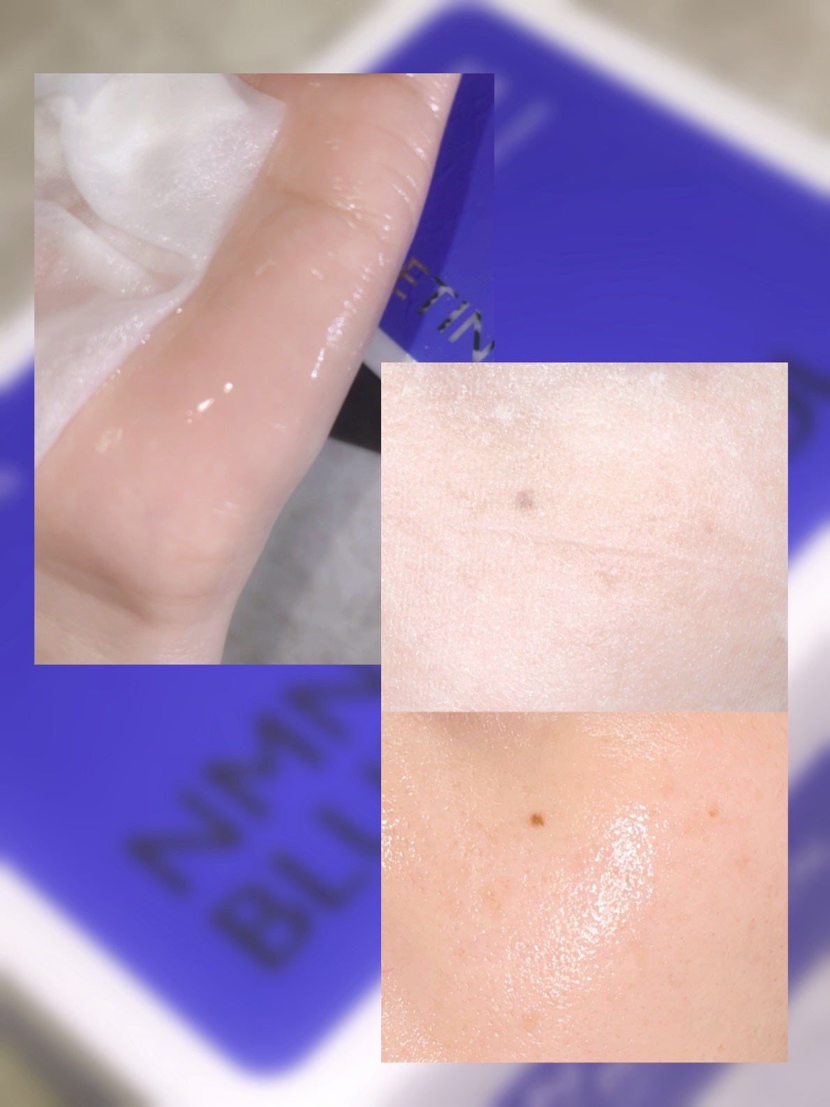 NMNブルースーパーレチノールデイリーターンオーバーマスク/Milk Touch/シートマスク・パックを使ったクチコミ(5枚目)