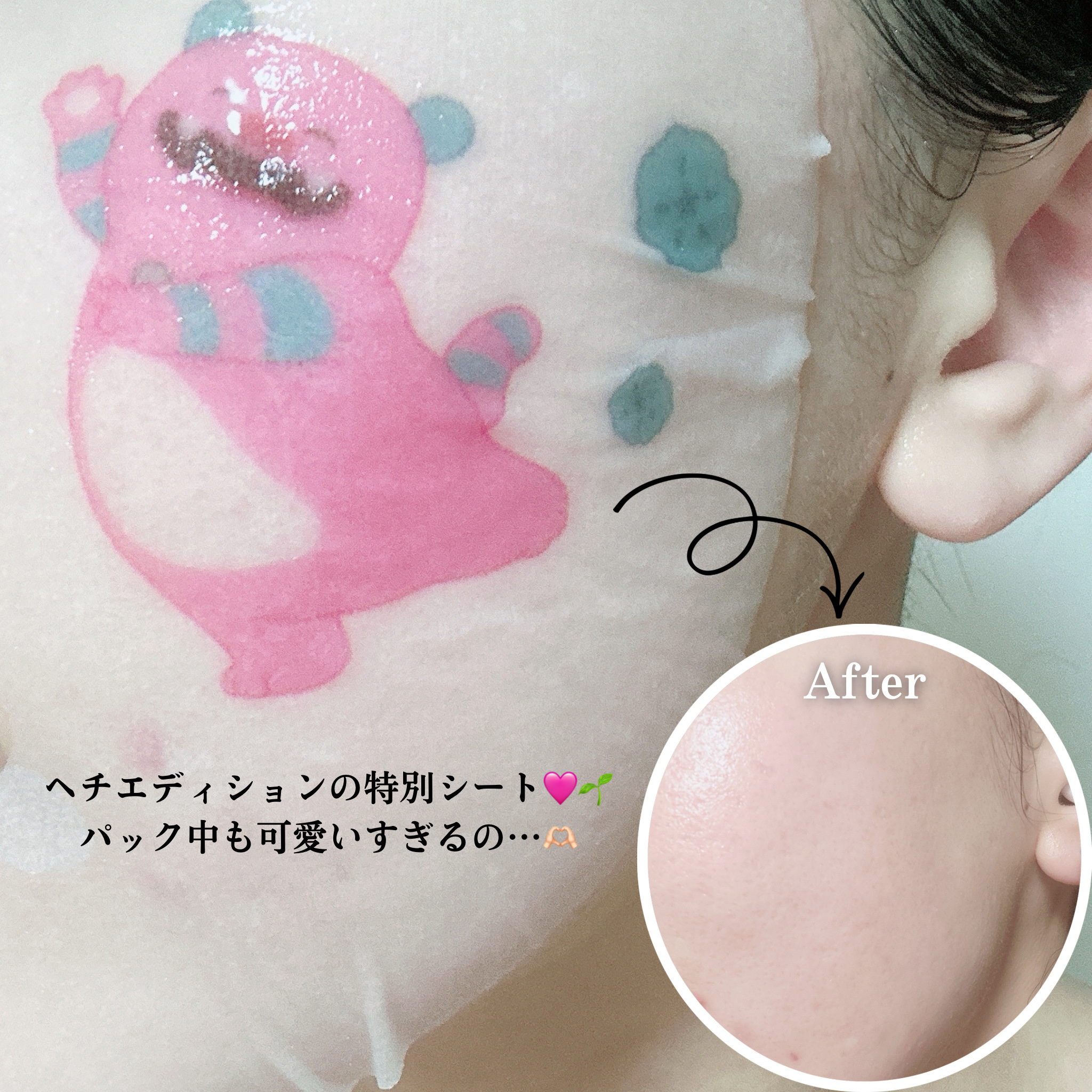 マデカッソシド エッセンシャルマスク/MEDIHEAL/シートマスク・パックを使ったクチコミ（3枚目）