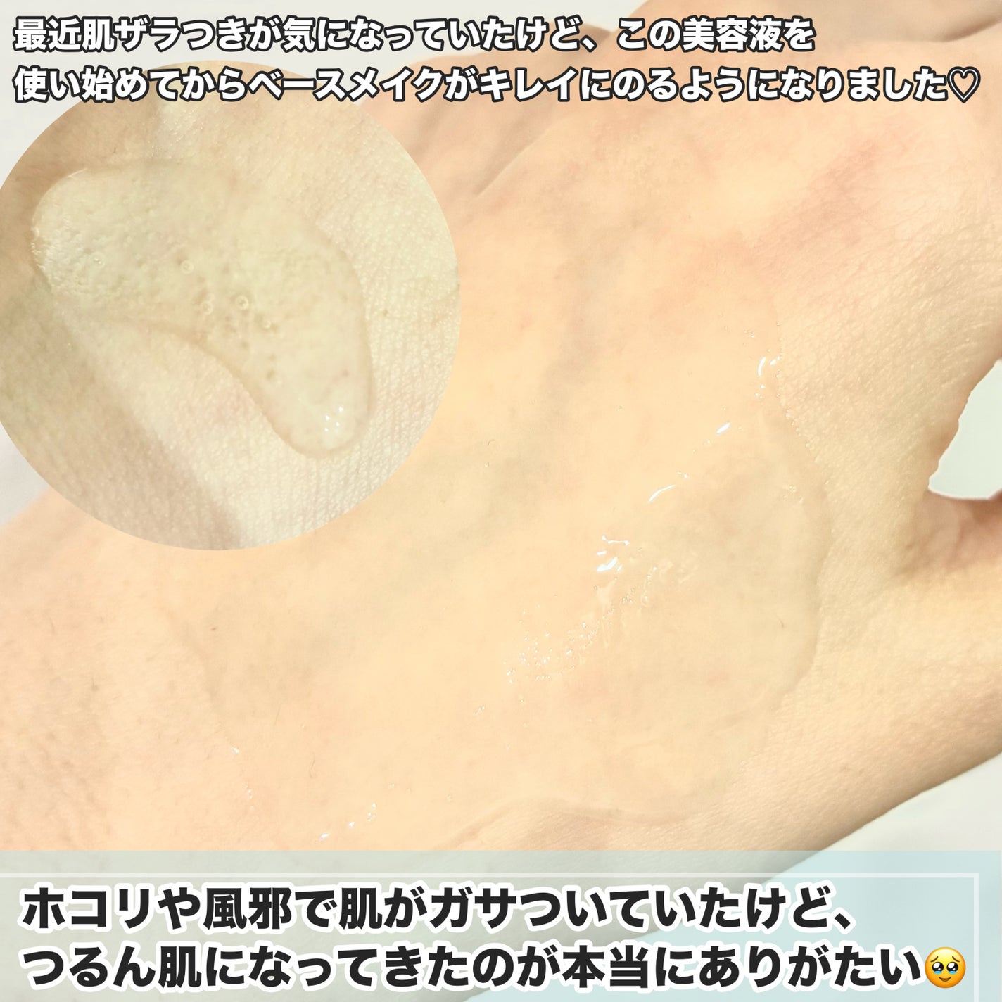 ヴィーガンAHA PHA アンプル/ureun/美容液を使ったクチコミ(3枚目)