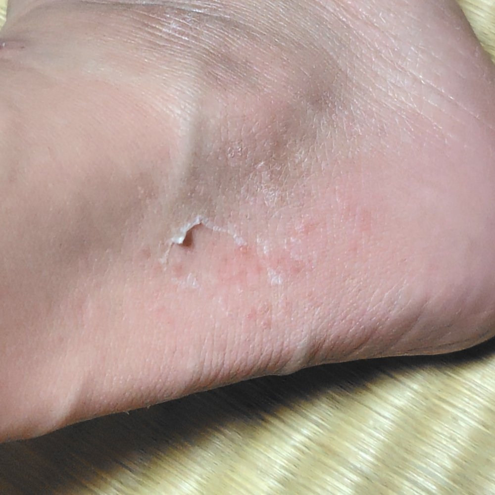 イージーパックDP60分タイプ/ベビーフット/レッグ・フットケアを使ったクチコミ（3枚目）