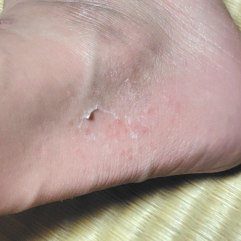 イージーパックDP60分タイプ/ベビーフット/レッグ・フットケアを使ったクチコミ(3枚目)