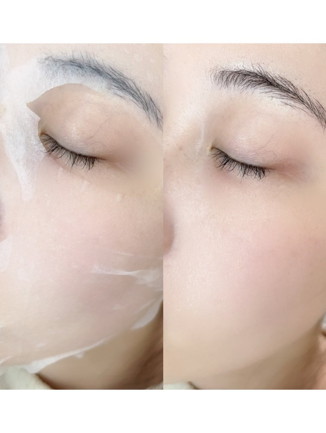 PDRN リフティングマスク/MEDIHEAL/シートマスク・パックを使ったクチコミ(5枚目)