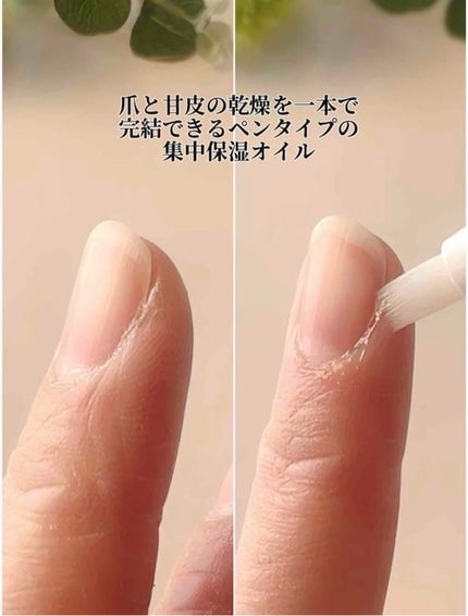ネイル&キューティクルケアエッセンスオイルペン/BAREN/ネイルオイル・トリートメントを使ったクチコミ(3枚目)