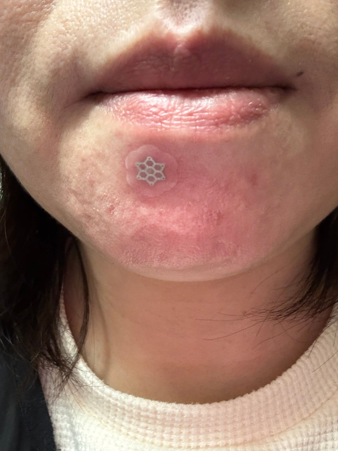 ACマグネシウムパッチ/スノーツープラス/シートマスク・パックを使ったクチコミ(4枚目)