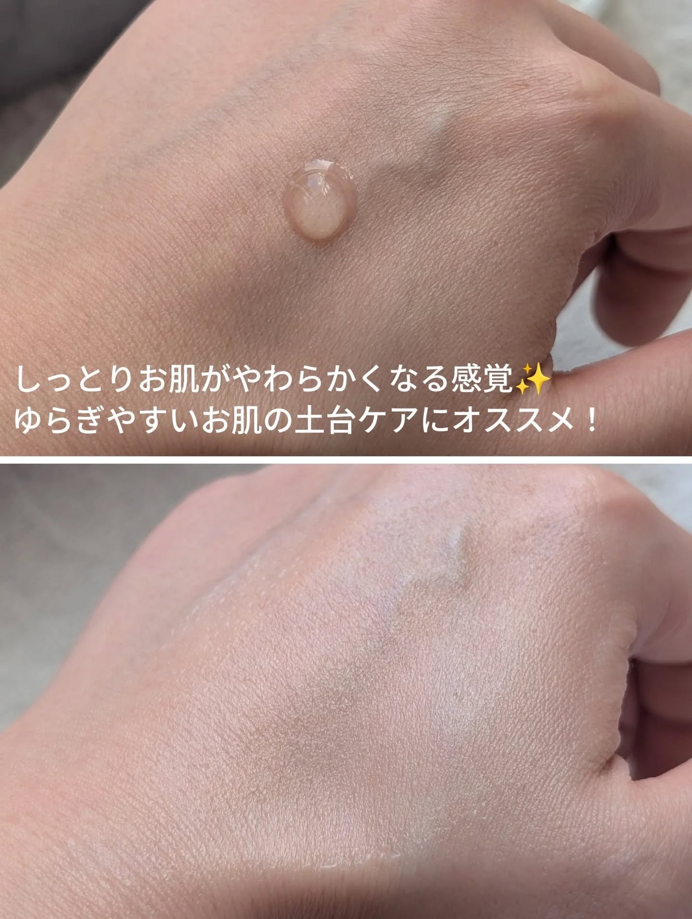 ファーメンテイショントナー/至貴/化粧水を使ったクチコミ(5枚目)