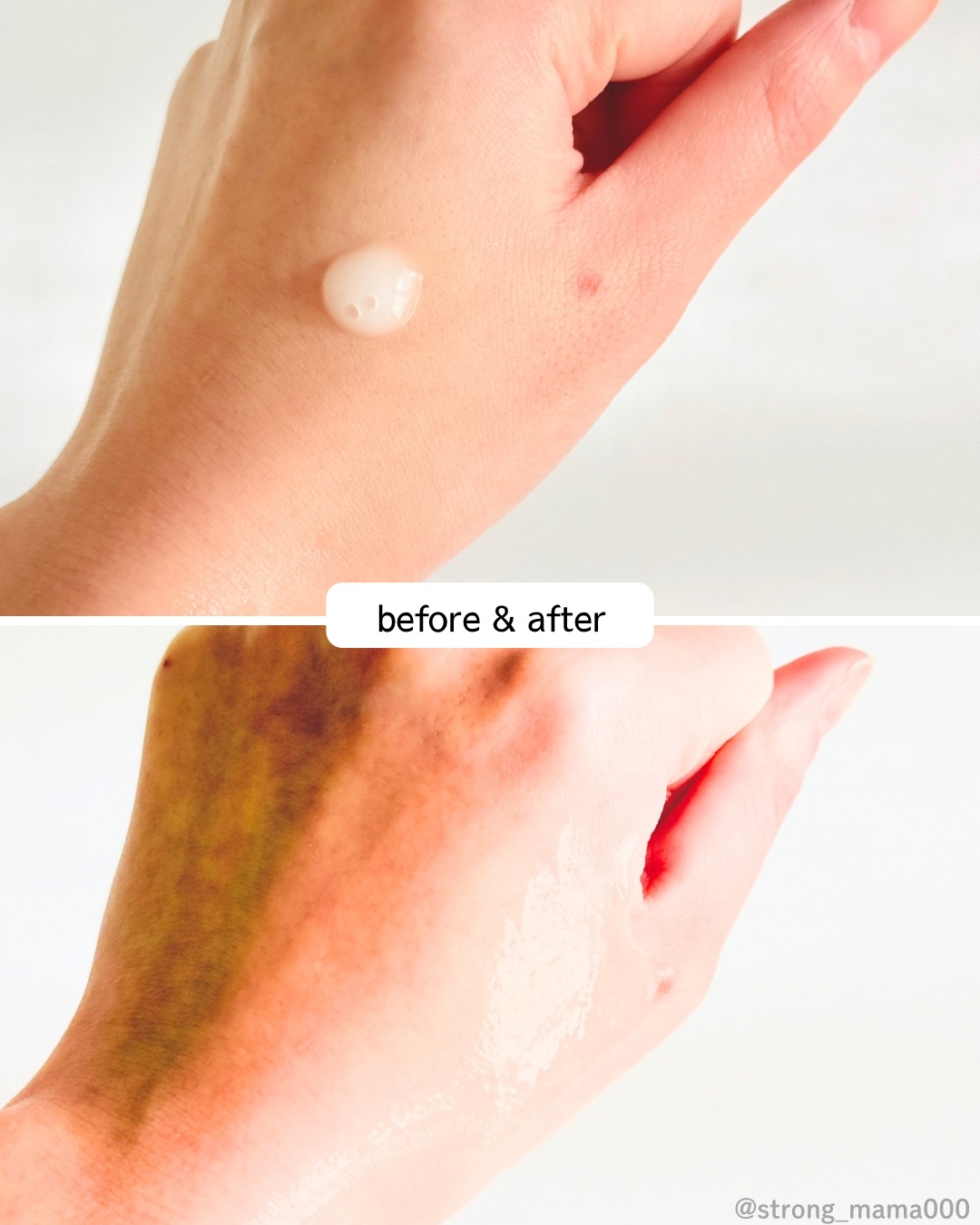 リードルショット300/VT/美容液を使ったクチコミ（3枚目）