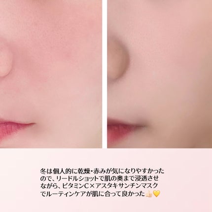 リードルショット300/VT/美容液を使ったクチコミ(5枚目)