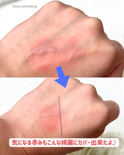 ダーマシンコンシーラー/23years old/リキッドコンシーラーを使ったクチコミ(3枚目)