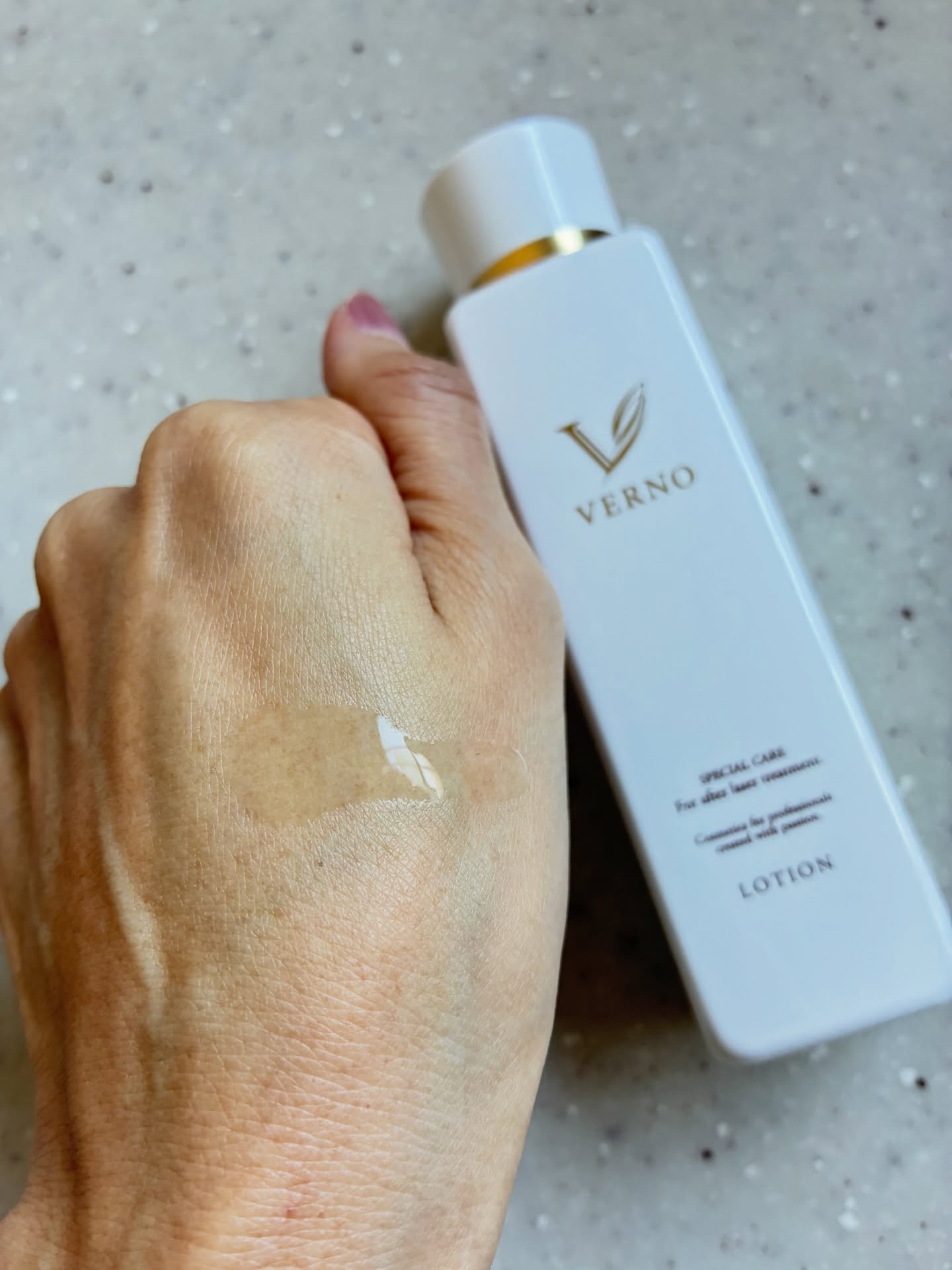 VERNO SKIN ローション〈医薬部外品〉/VERNO SKIN CARE/化粧水を使ったクチコミ（1枚目）