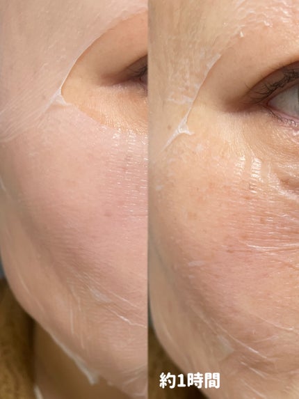 トラブルパッチマスク/EIOM/その他スキンケアを使ったクチコミ(3枚目)