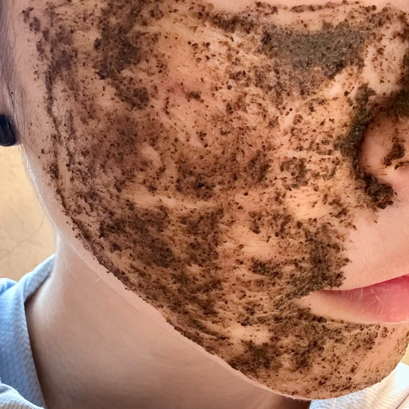 ãã£ãŒããªãŒããŒãããŒãªã³ã°ããã¯/WellDerma/æŽãæµãããã¯ã»ãã¹ã¯ã䜿ã£ãã¯ãã³ãïŒ3æç®ïŒ