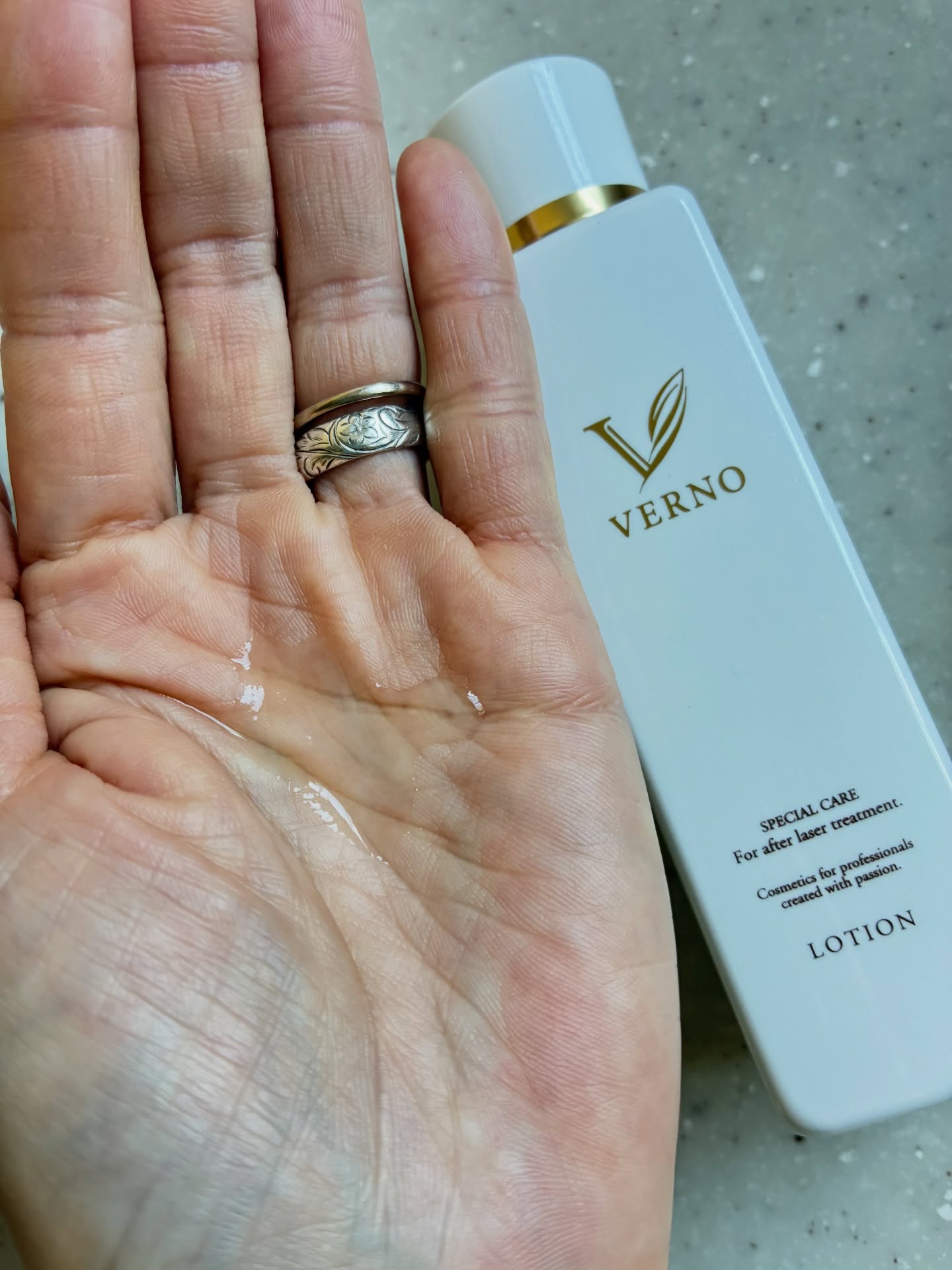 VERNO SKIN ローション〈医薬部外品〉/VERNO SKIN CARE/化粧水を使ったクチコミ（2枚目）