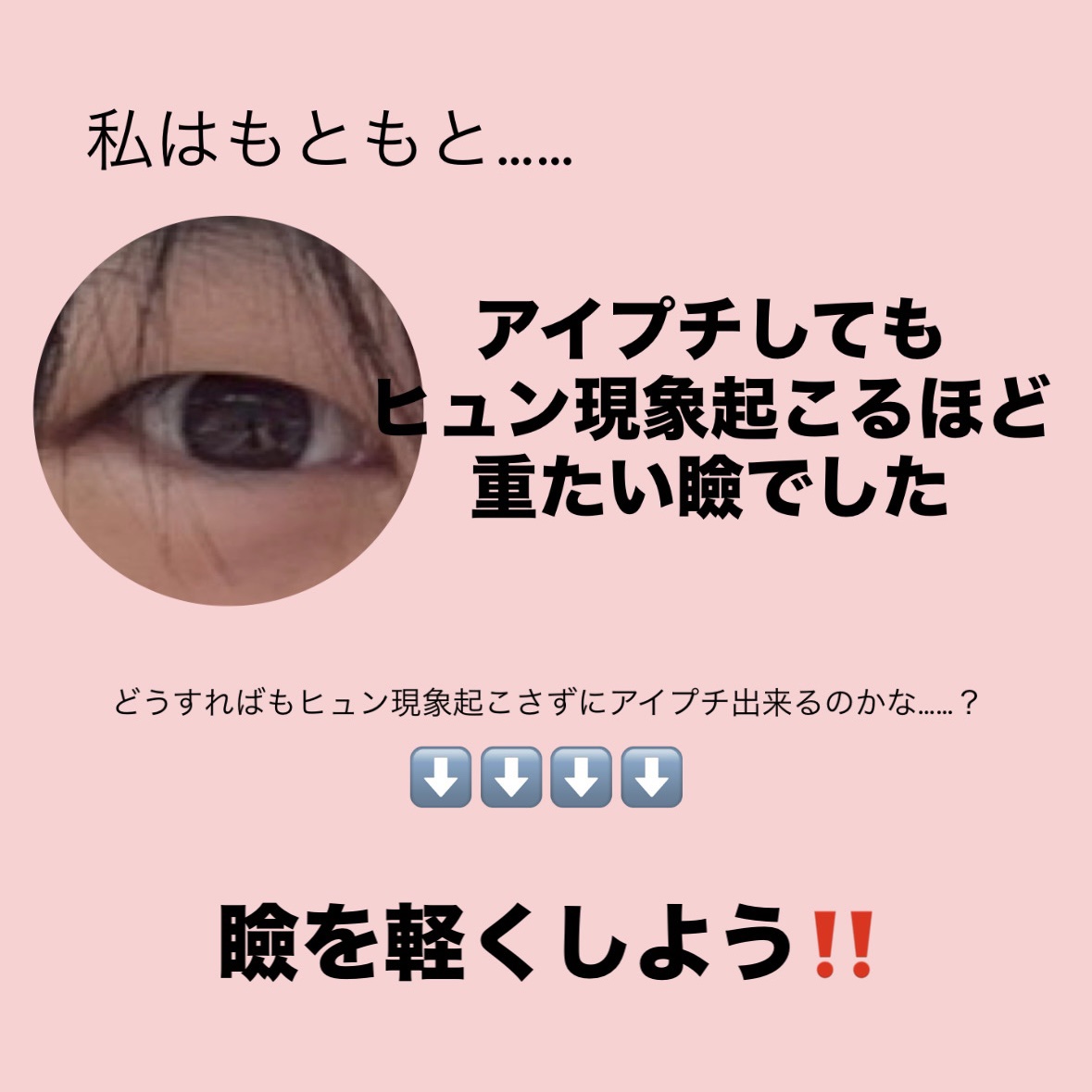 のびーるアイテープ（絆創膏タイプ、レギュラー）/DAISO/二重まぶた用アイテムを使ったクチコミ（2枚目）