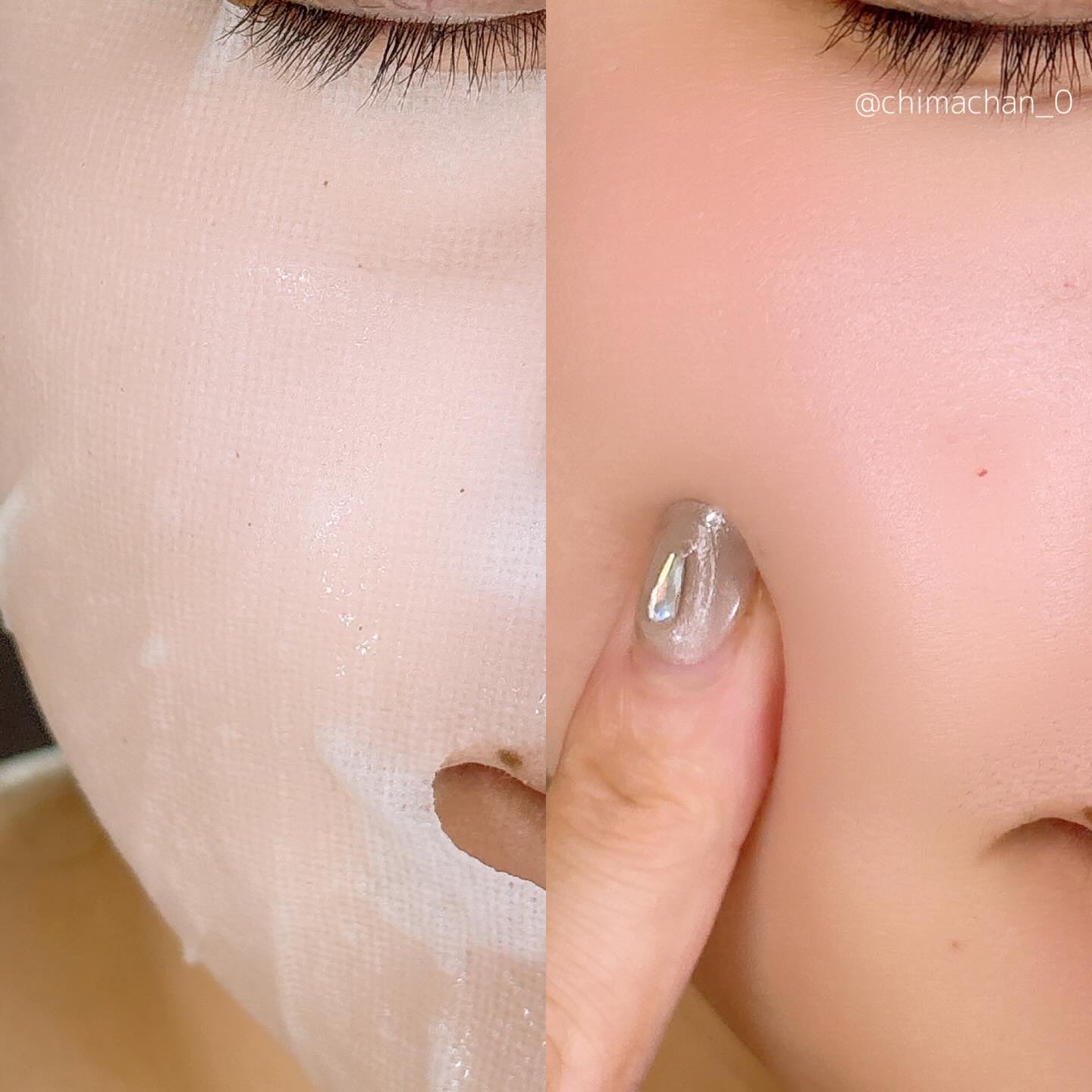 どんぐりスピキュールマスク/Xingga/シートマスク・パックを使ったクチコミ（3枚目）