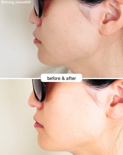 リードルショット300/VT/美容液を使ったクチコミ(4枚目)